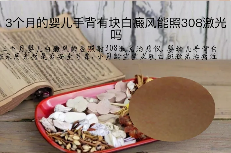 3个月的婴儿手背有块白癜风能照308激光吗