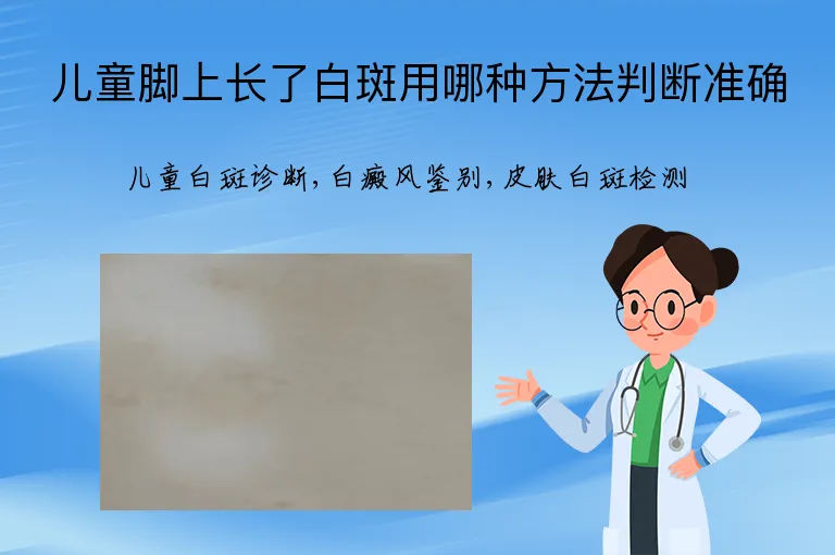 儿童脚上长了白斑用哪种方法判断准确