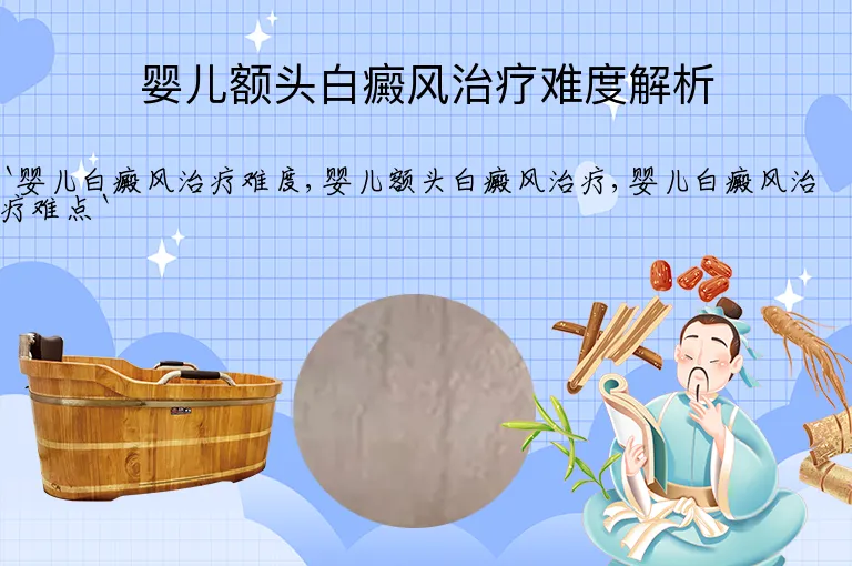 婴儿额头白癜风治疗难度解析
