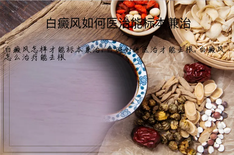 白癜风如何医治能标本兼治