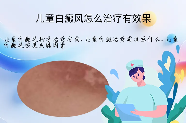 儿童白癜风怎么治疗有效果