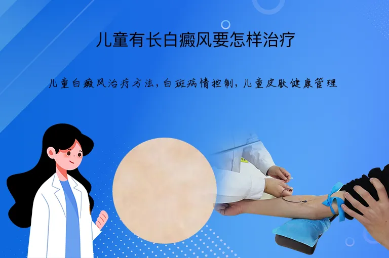 儿童有长白癜风要怎样治疗