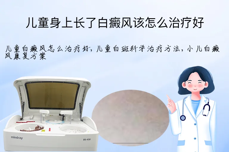 儿童身上长了白癜风该怎么治疗好