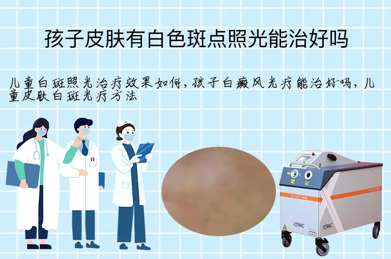 孩子皮肤有白色斑点照光能治好吗