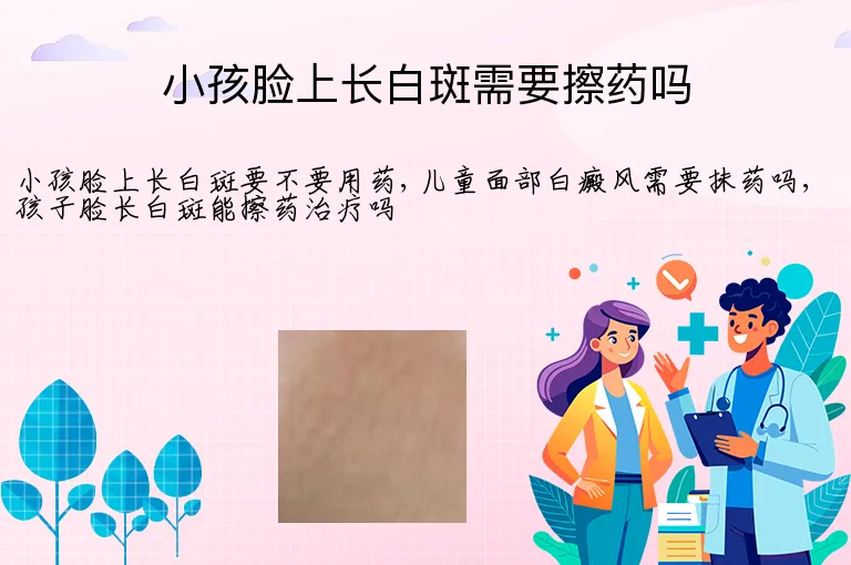 小孩脸上长白斑需要擦药吗