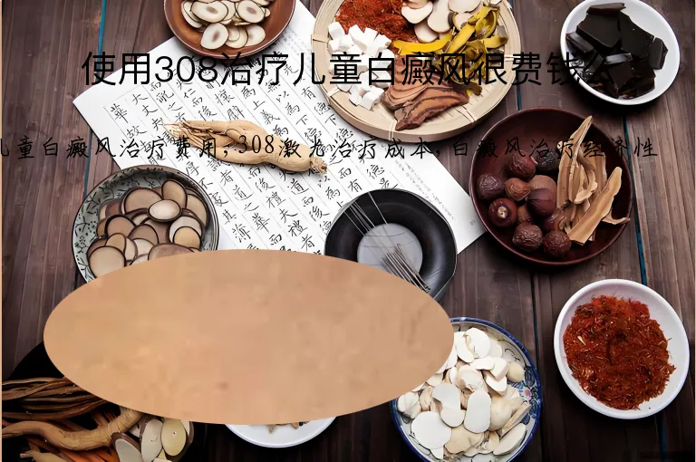 使用308治疗儿童白癜风很费钱么