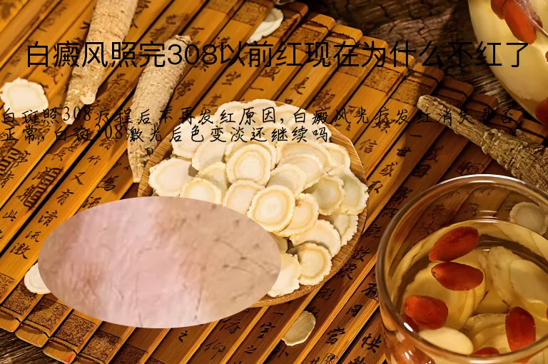 白癜风照完308以前红现在为什么不红了