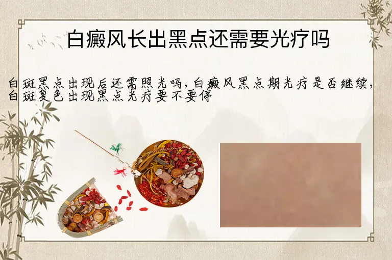 白癜风长出黑点还需要光疗吗