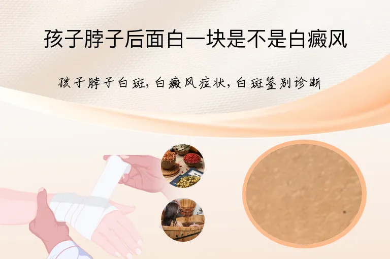 孩子脖子后面白一块是不是白癜风