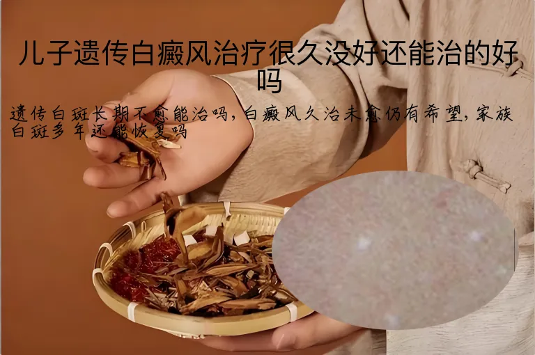 儿子遗传白癜风治疗很久没好还能治的好吗