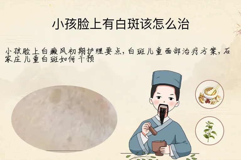 小孩脸上有白斑该怎么治