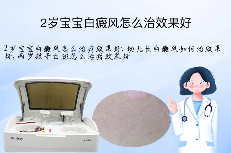 2岁宝宝白癜风怎么治效果好