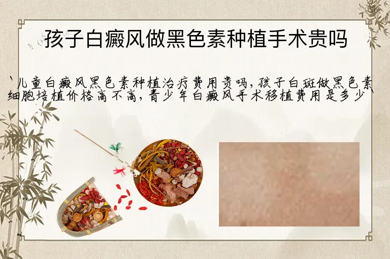 孩子白癜风做黑色素种植手术贵吗