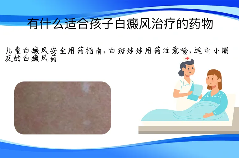 有什么适合孩子白癜风治疗的药物