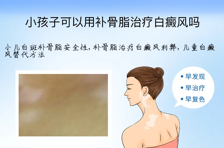 小孩子可以用补骨脂治疗白癜风吗