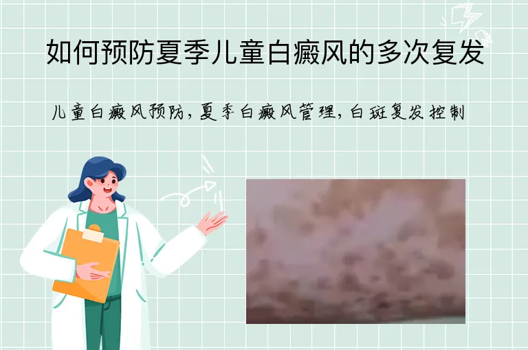 如何预防夏季儿童白癜风的多次复发