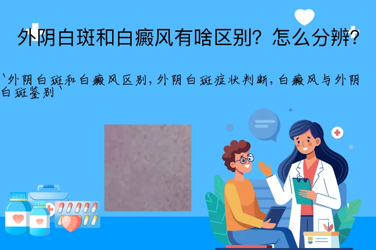 外阴白斑和白癜风有啥区别？怎么分辨？