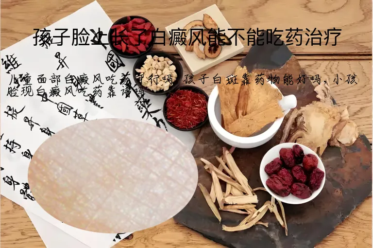 孩子脸上长了白癜风能不能吃药治疗