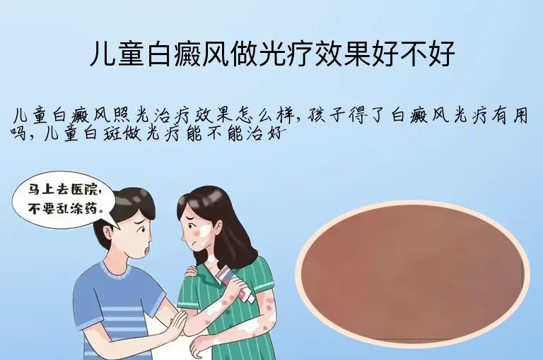 儿童白癜风做光疗效果好不好