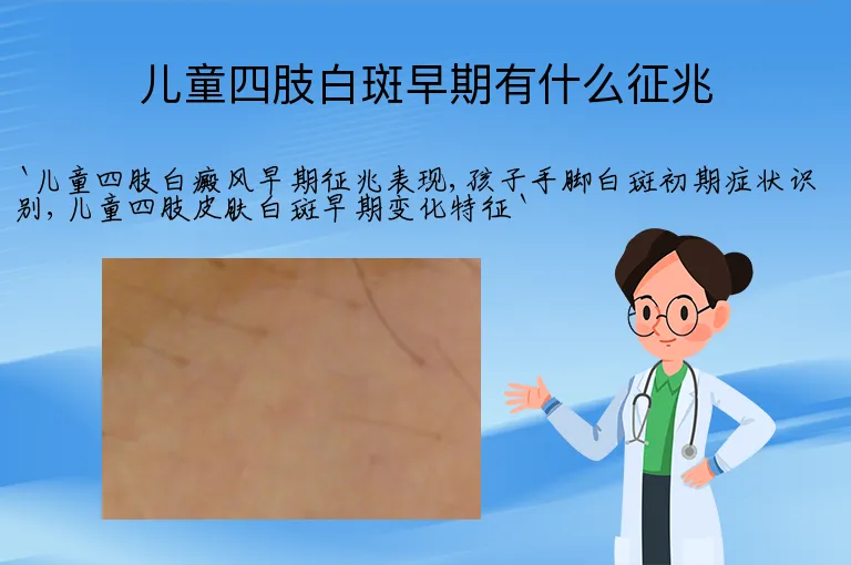 儿童四肢白斑早期有什么征兆