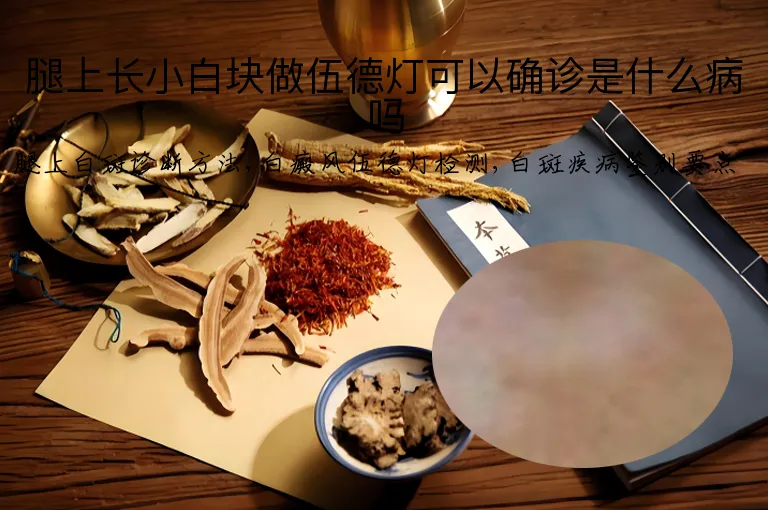 腿上长小白块做伍德灯可以确诊是什么病吗