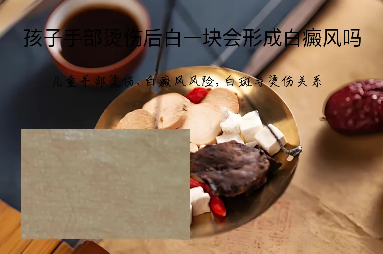 孩子手部烫伤后白一块会形成白癜风吗