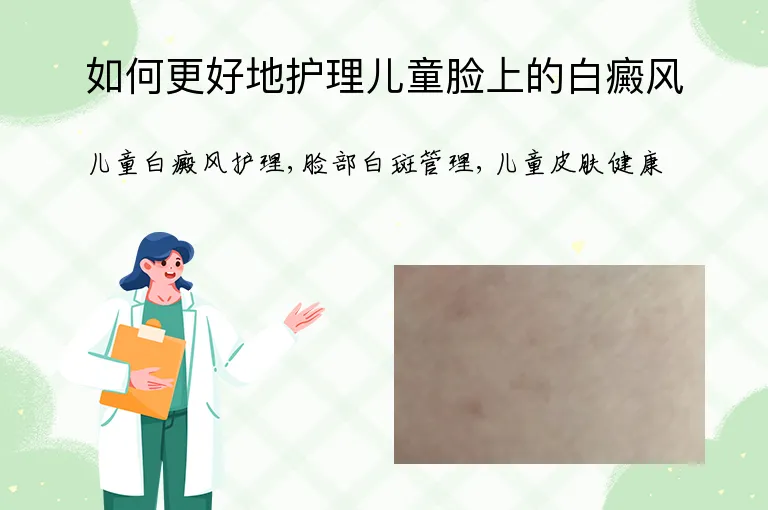 如何更好地护理儿童脸上的白癜风