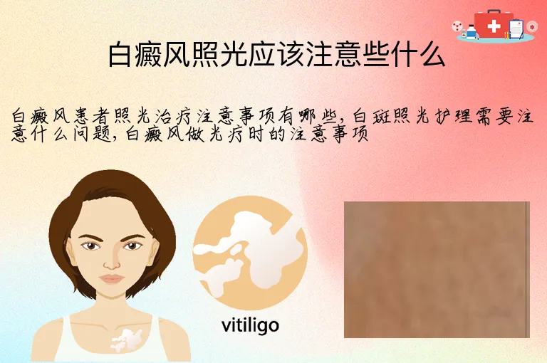 白癜风照光应该注意些什么