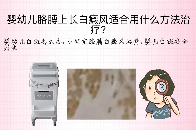 婴幼儿胳膊上长白癜风适合用什么方法治疗?