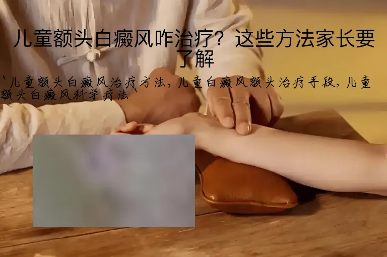 儿童额头白癜风咋治疗？这些方法家长要了解