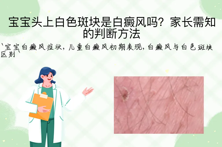 宝宝头上白色斑块是白癜风吗？家长需知的判断方法