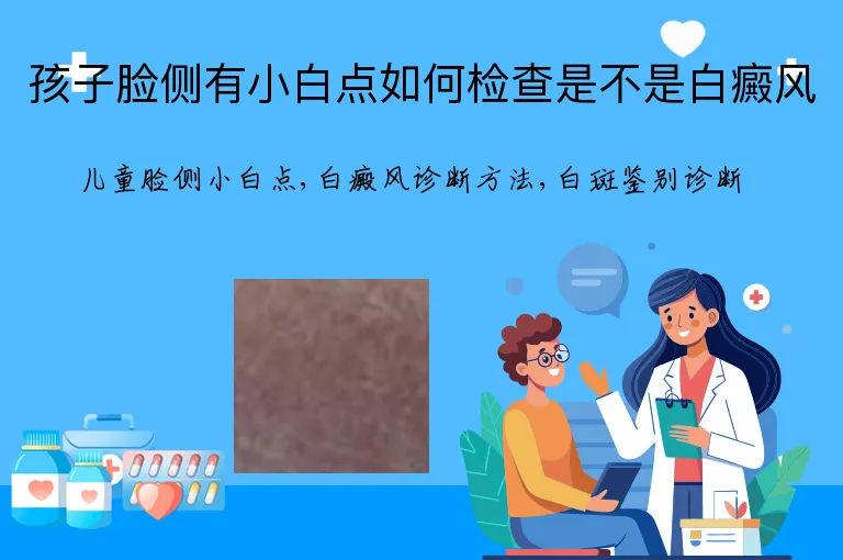 孩子脸侧有小白点如何检查是不是白癜风