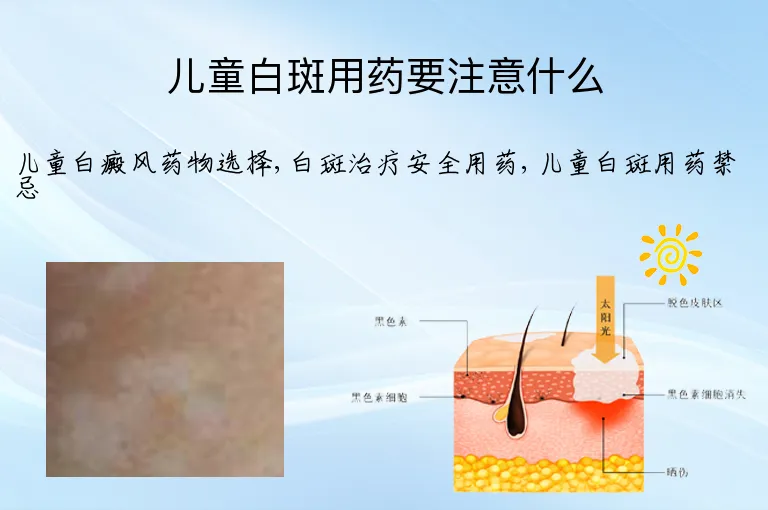 儿童白斑用药要注意什么