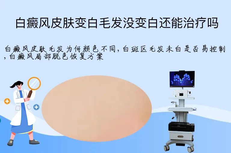 白癜风皮肤变白毛发没变白还能治疗吗