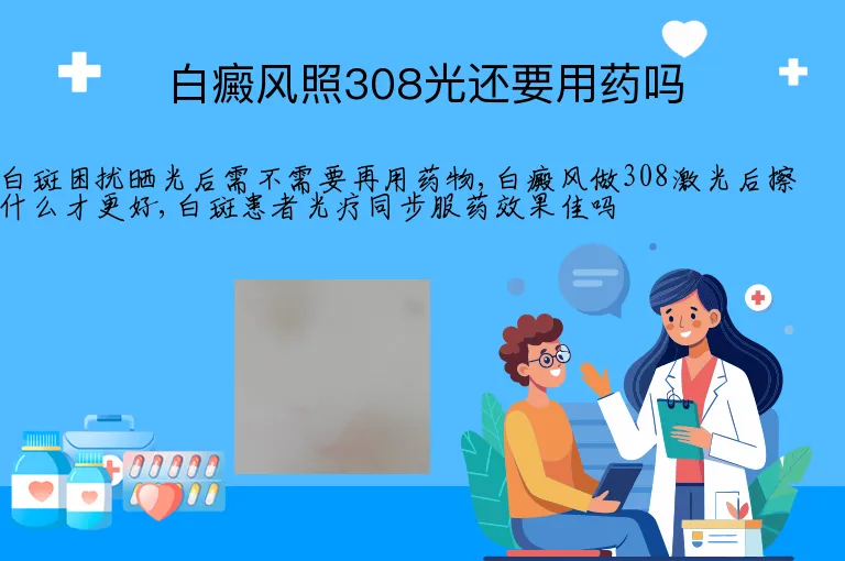 白癜风照308光还要用药吗