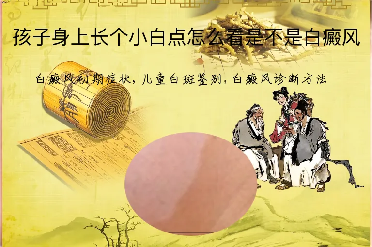 孩子身上长个小白点怎么看是不是白癜风