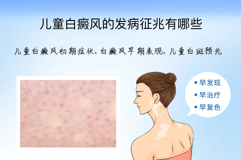 儿童白癜风的发病征兆有哪些