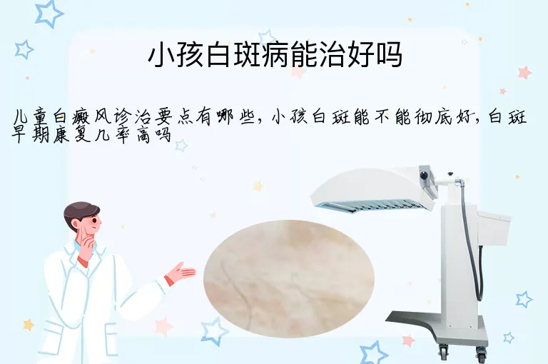 小孩白斑病能治好吗