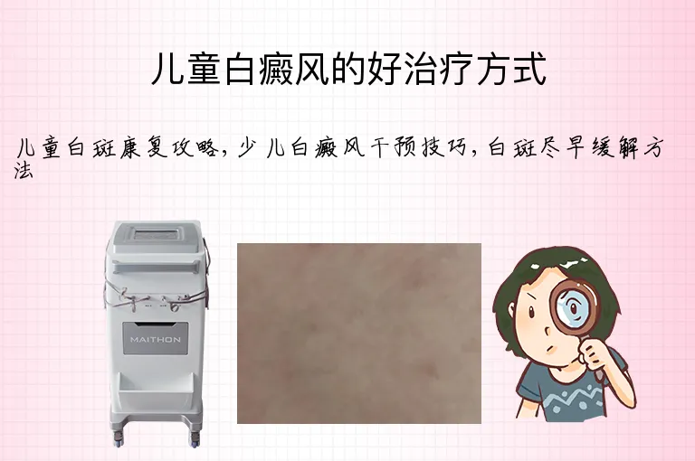 儿童白癜风的好治疗方式