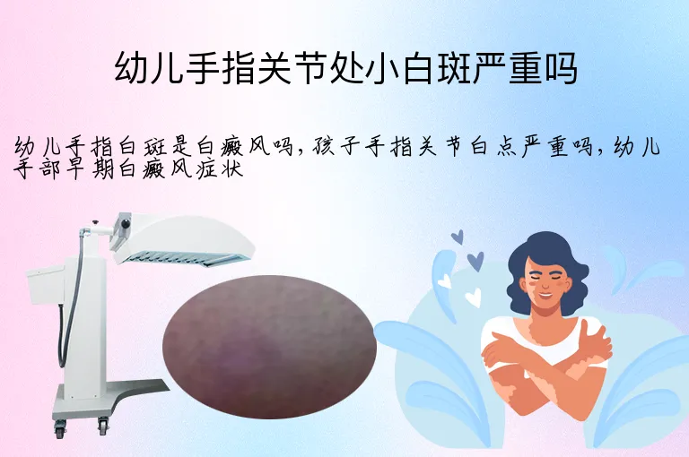 幼儿手指关节处小白斑严重吗