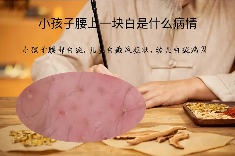 小孩子腰上一块白是什么病情