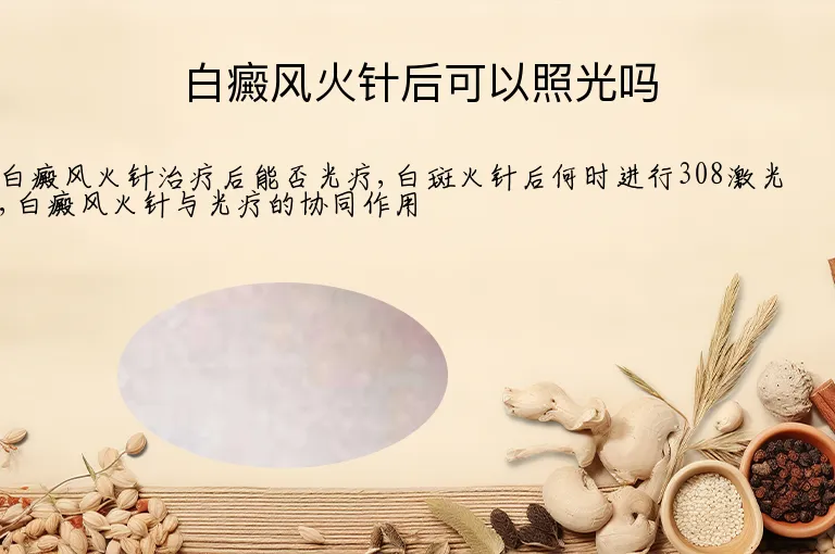 白癜风火针后可以照光吗