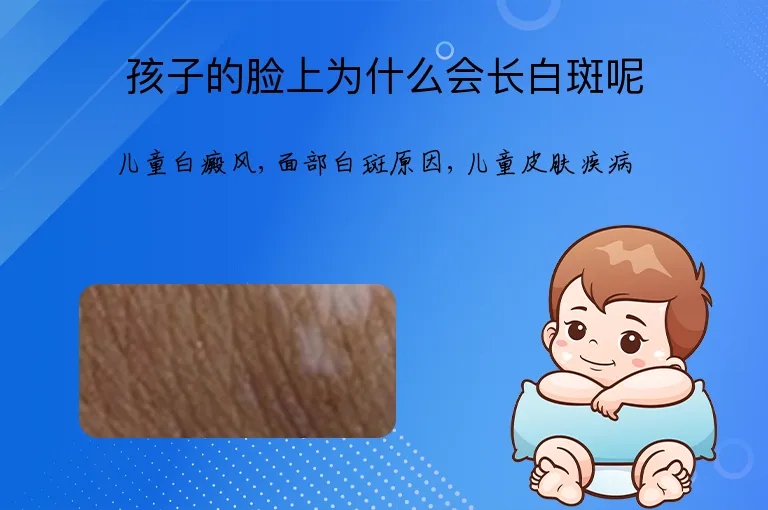 孩子的脸上为什么会长白斑呢