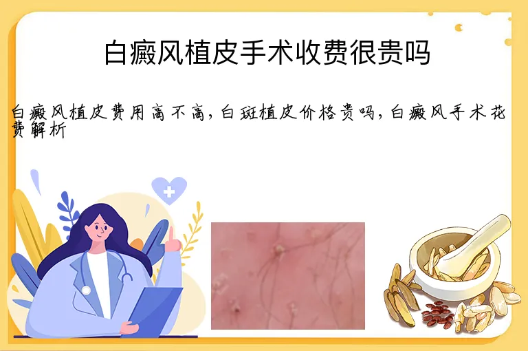 白癜风植皮手术收费很贵吗