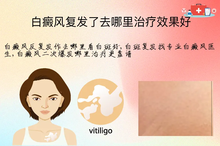 白癜风复发了去哪里治疗效果好
