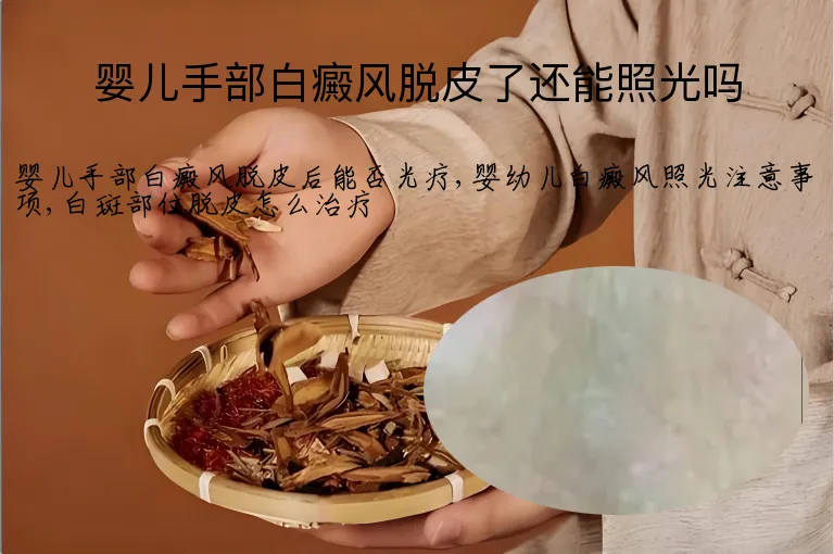 婴儿手部白癜风脱皮了还能照光吗