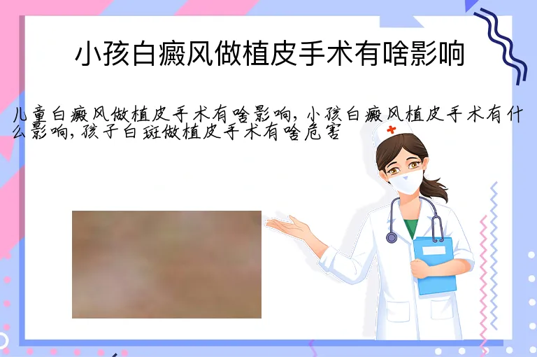 小孩白癜风做植皮手术有啥影响