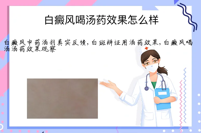 白癜风喝汤药效果怎么样