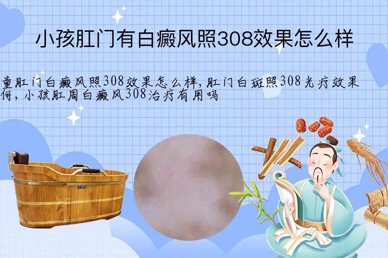 小孩肛门有白癜风照308效果怎么样