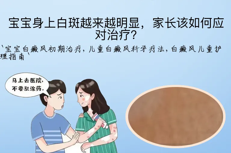 宝宝身上白斑越来越明显，家长该如何应对治疗？